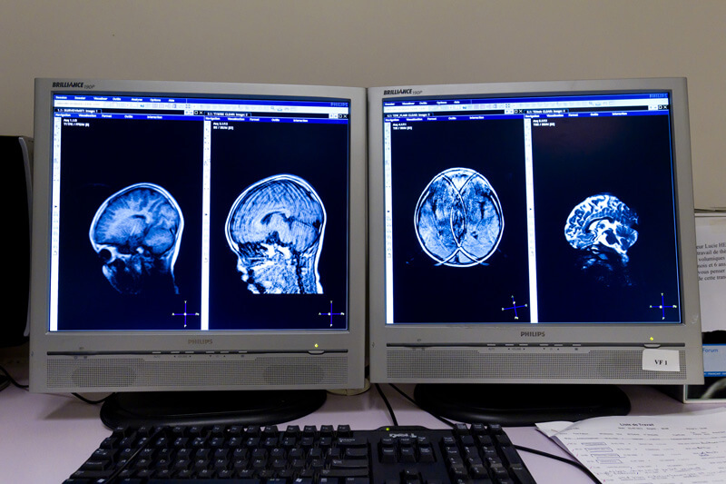 Illustration scanner pédiatrique